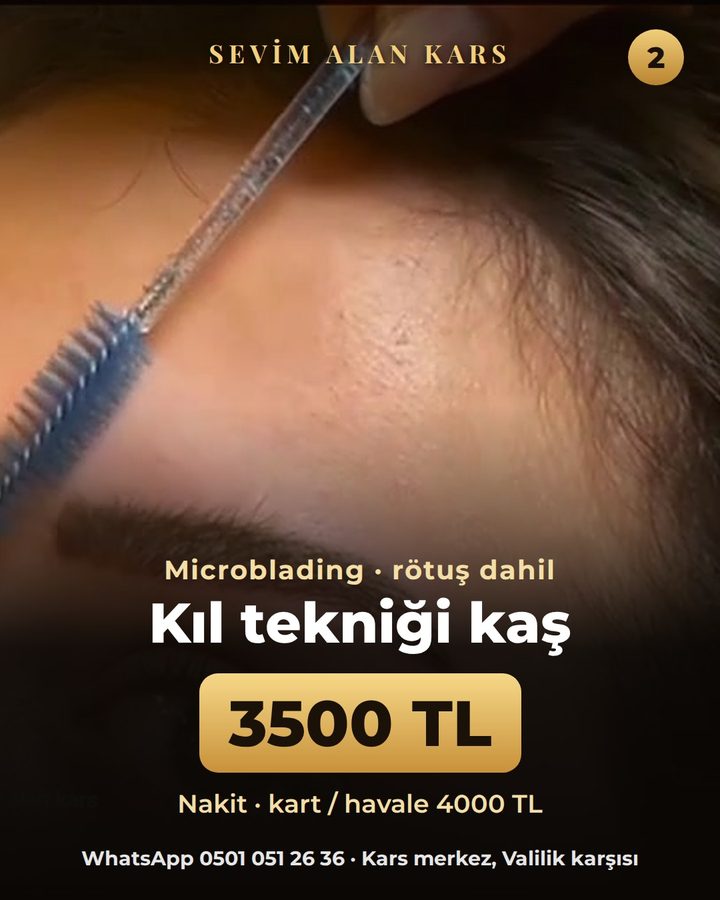 Bu ay en çok sorulan bakımlar 3